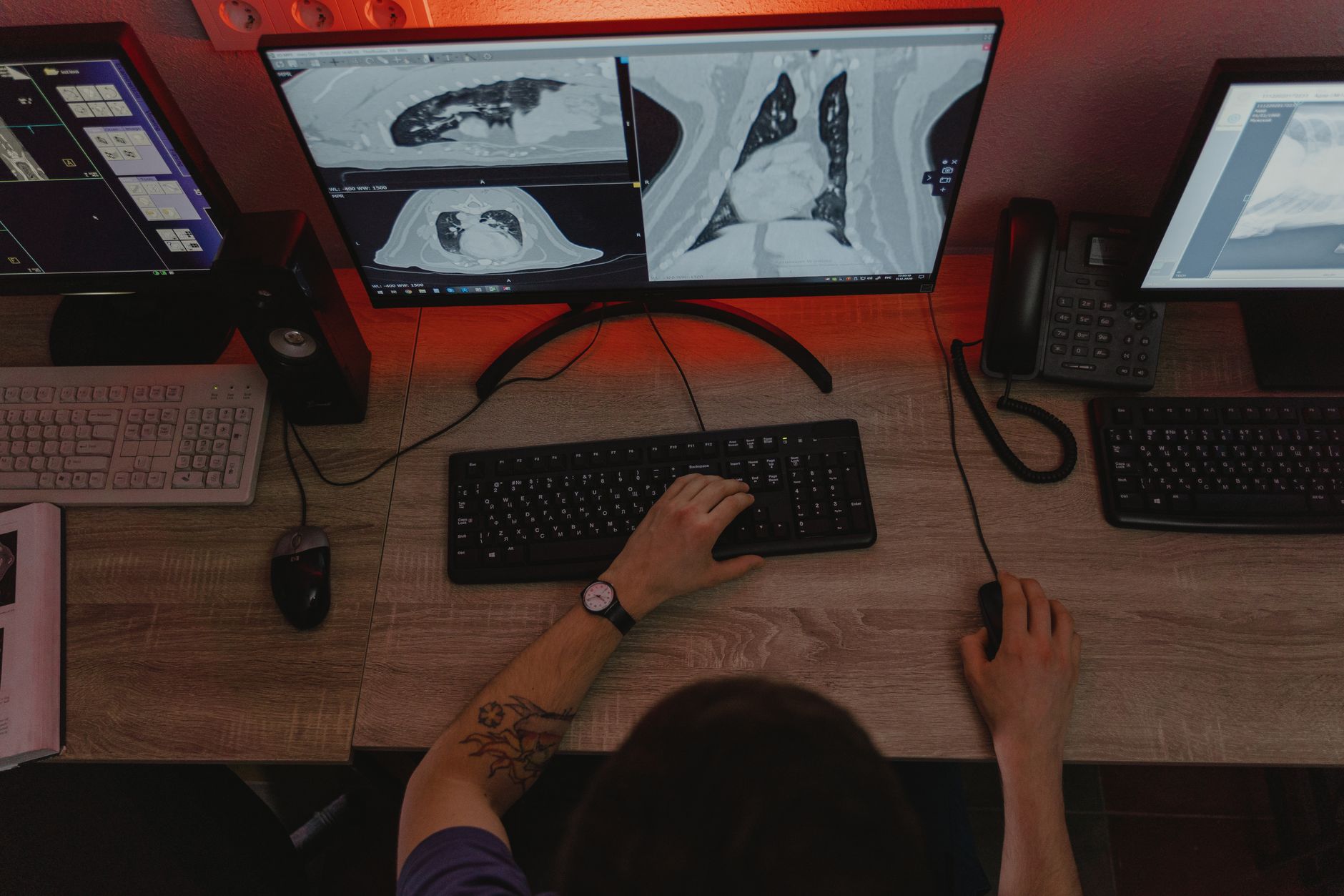 Tonbo Imaging IPO: The Smart Subscription Status Update
